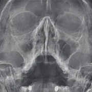 Центр диагностики челюстно-лицевой области Пикассо фото 1 на сайте MoeOtradnoe.ru