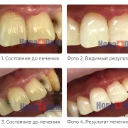 Стоматологическая клиника НоваДент на улице Хачатуряна фото 1 на сайте MoeOtradnoe.ru