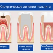Стоматологическая клиника НоваДент на улице Хачатуряна фото 3 на сайте MoeOtradnoe.ru