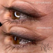 Студия перманентного макияжа Laritattoo фото 14 на сайте MoeOtradnoe.ru