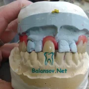 Зуботехническая лаборатория Ваша Медицина фото 3 на сайте MoeOtradnoe.ru