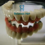 Зуботехническая лаборатория Ваша Медицина фото 1 на сайте MoeOtradnoe.ru
