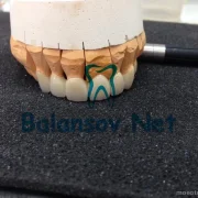 Зуботехническая лаборатория Ваша Медицина фото 7 на сайте MoeOtradnoe.ru